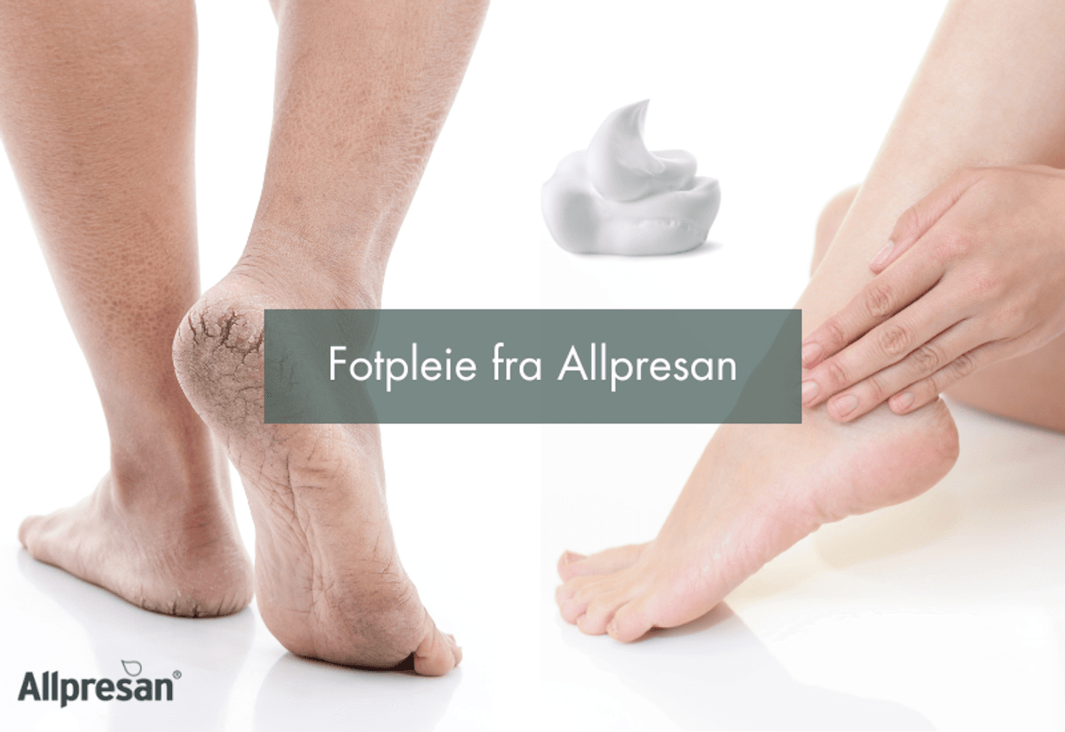 Allpresan fotkrem kremskum diabetic