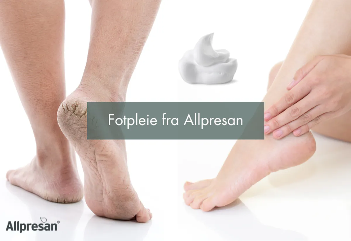Allpresan fotkrem kremskum diabetic